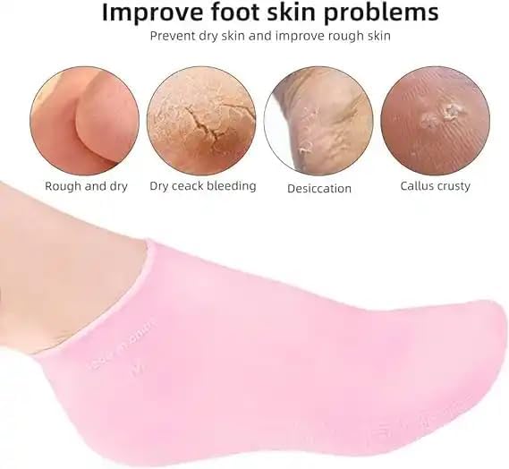 Moisturizing Silicone Spa Gel Socks for Women Men for Dry Feet Cracked Heel Callus Remover Vitamin E Repair (Pink)